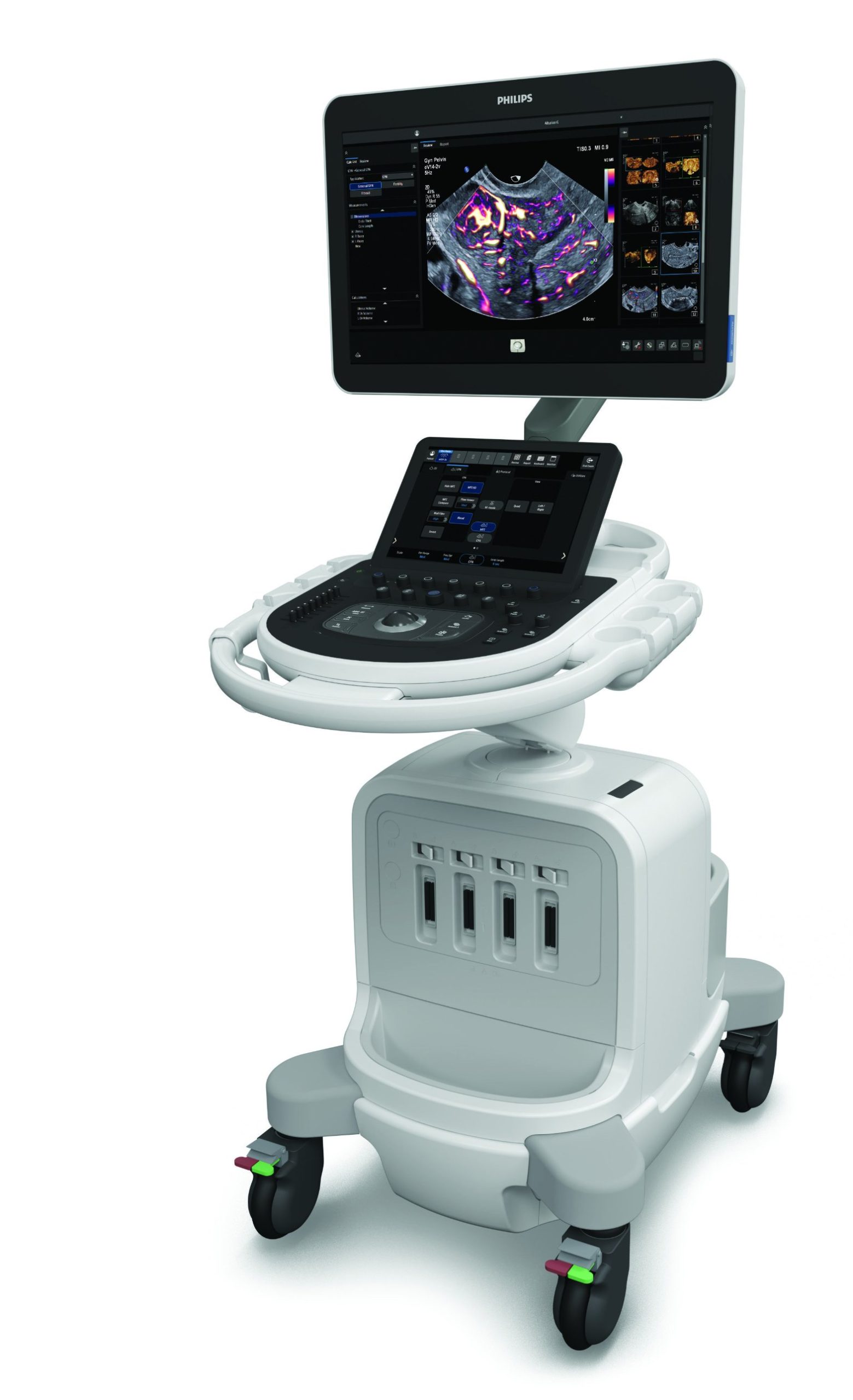 Ultrassom Philips Alturion